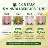Some By Mi Bye Bye Blackhead 30 Days Miracle Green Tea Tox Bubble Cleanser 120ml / 4.23 oz