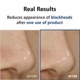 IsNtree Hyper Acid 4 (AHA BHA PHA LAH) 30 Serum 20ml / 0.67 fl. oz.