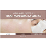 Dr.Ceuracle Vegan Kombucha Tea Essence 5.07 fl.oz. / 150ml