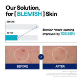 <RED> (RENEWED) MEDIHEAL Madecassoside Repair Serum 1.35 fl.oz