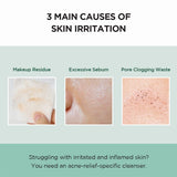 <RED> Skin1004 Centella Tea-Trica BHA Cleansing Foam 125ml / 4.22 fl.oz