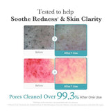 Medicube Azelaic Acid Niacinamide Deep Clean Foam Cleanser 120g