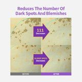 <RED> Sungboon Editor Meoru Podo Vita C Dark Spot Ampoule 30ml