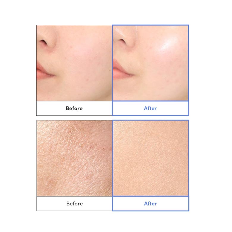 EqqualBerry Swimming Pool Toner 300ml – NATURE HUB