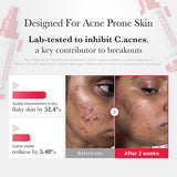 <RED> Medicube Hypochlorous Acid Daily Facial Mist Spray 125ml