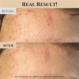 <MALL><NH> Beauty of Joseon Ground Rice and Honey Glow Mask 150ml, 5.07 fl.oz