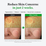 <RED> Dr.Althea Gentle Vitamin C Serum 20% 30ml / 1.01 fl.oz.