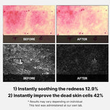 Medicube Super Cica Pad 150g / 70 pads